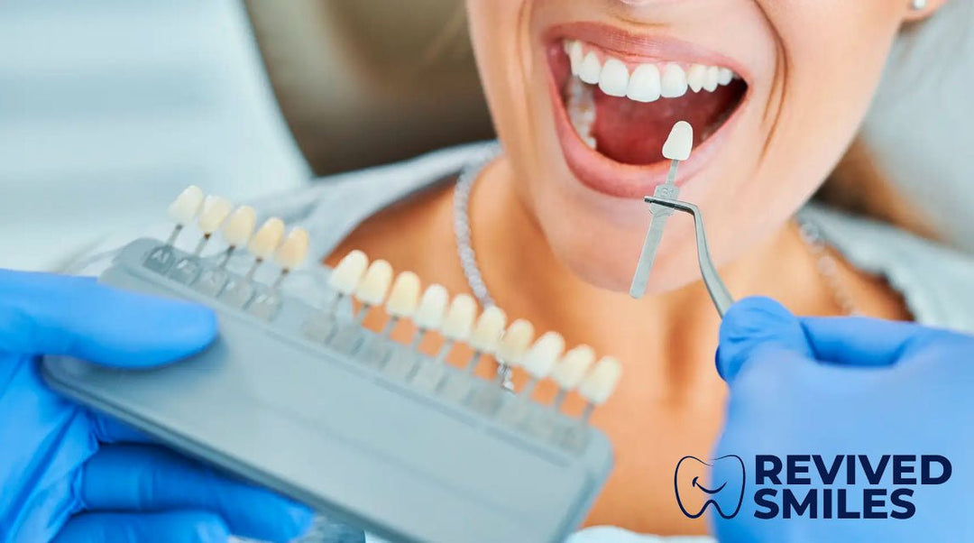 Finding the Perfect Tooth and Gums Shades for Removable Dentures