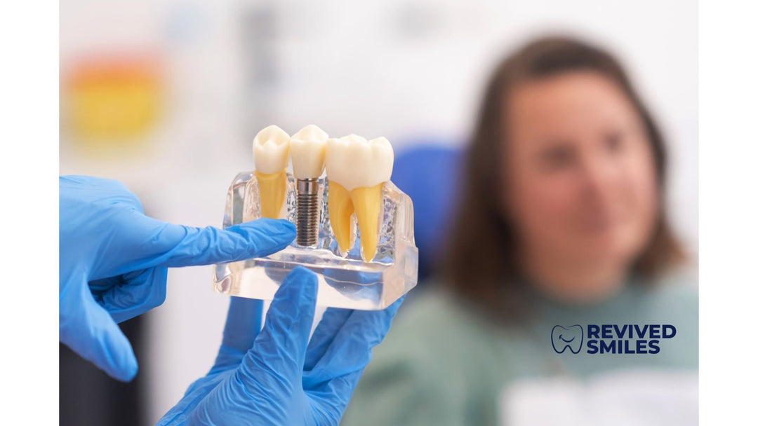 Explorando los diferentes tipos de soluciones de reemplazo dental