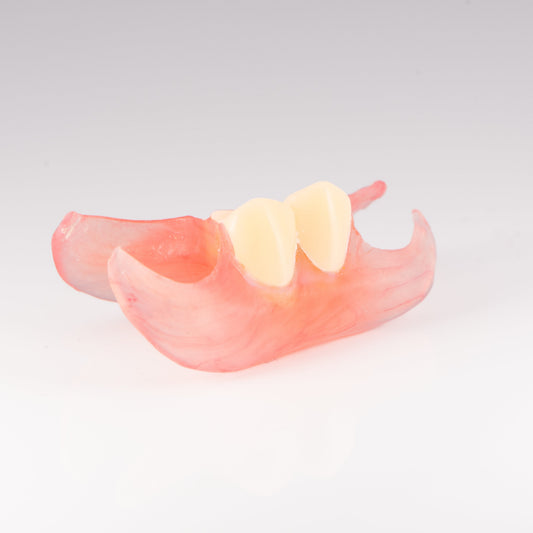 Two Tooth Unilateral Partial Denture