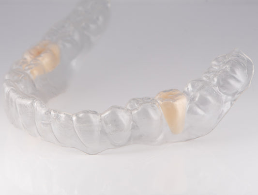 Essix Partial Denture Retainer