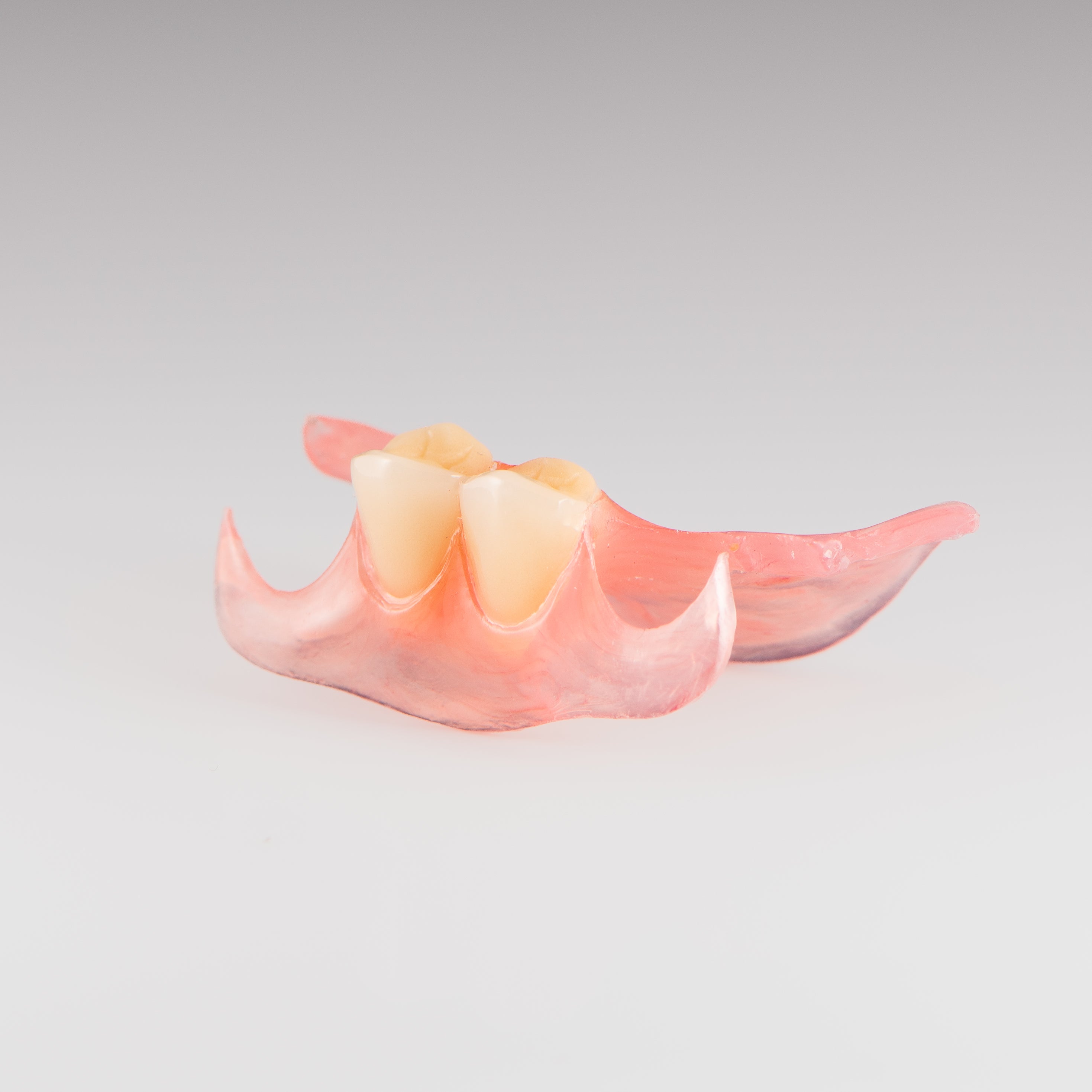 Two-Tooth Unilateral Partial Denture on Gray Background