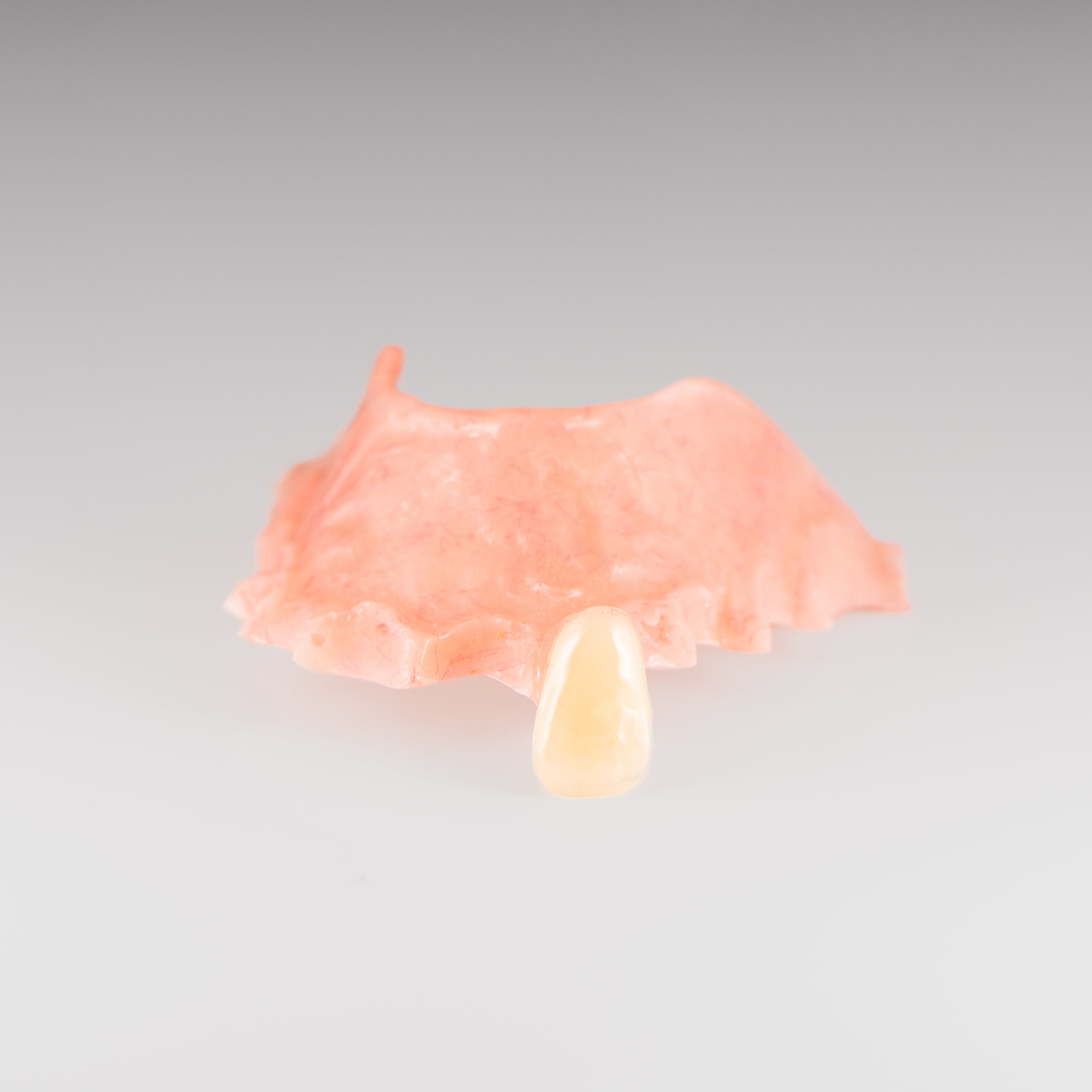 One-Tooth Acrylic Partial Denture on Gray Background