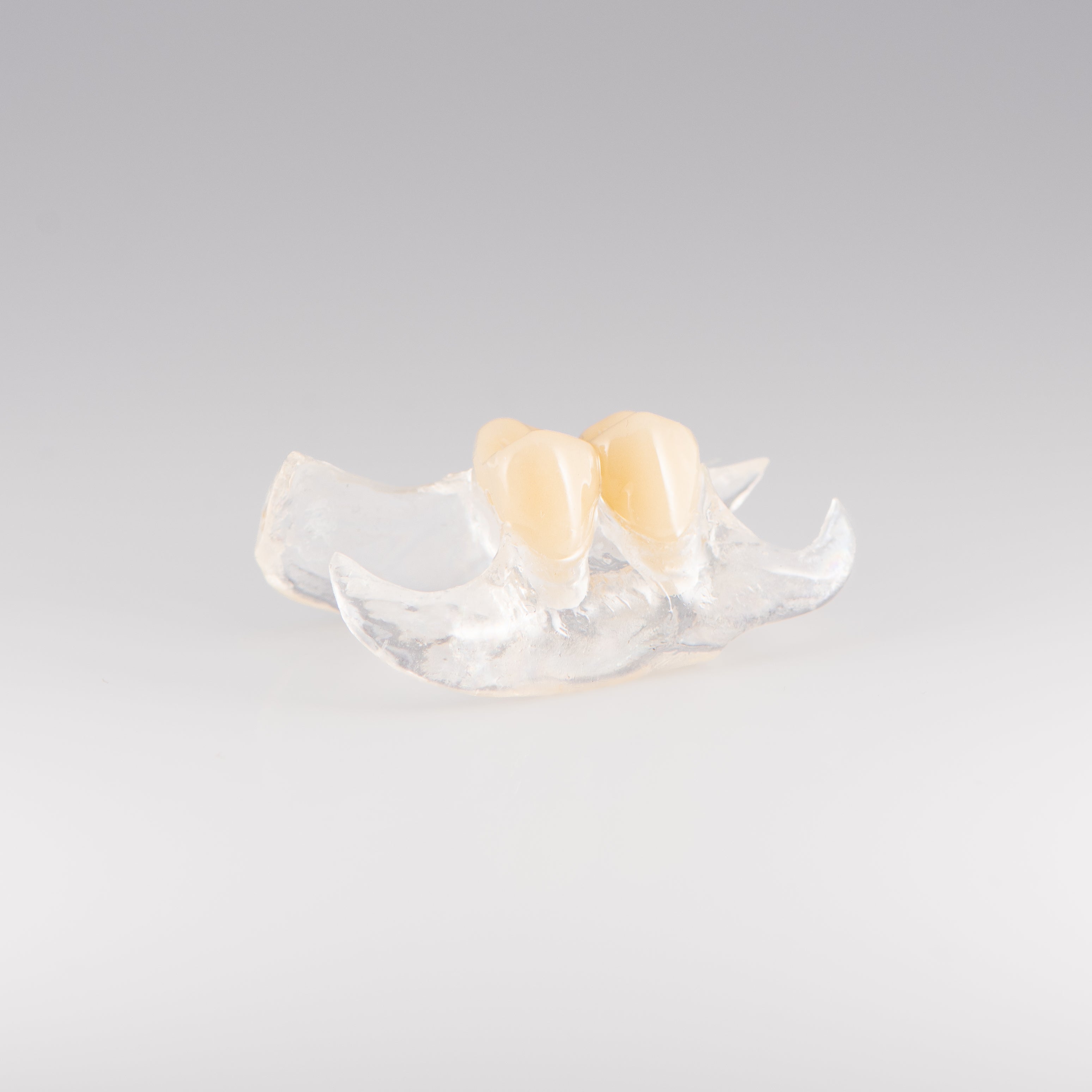 Clear Unilateral Partial Denture with Gray Background