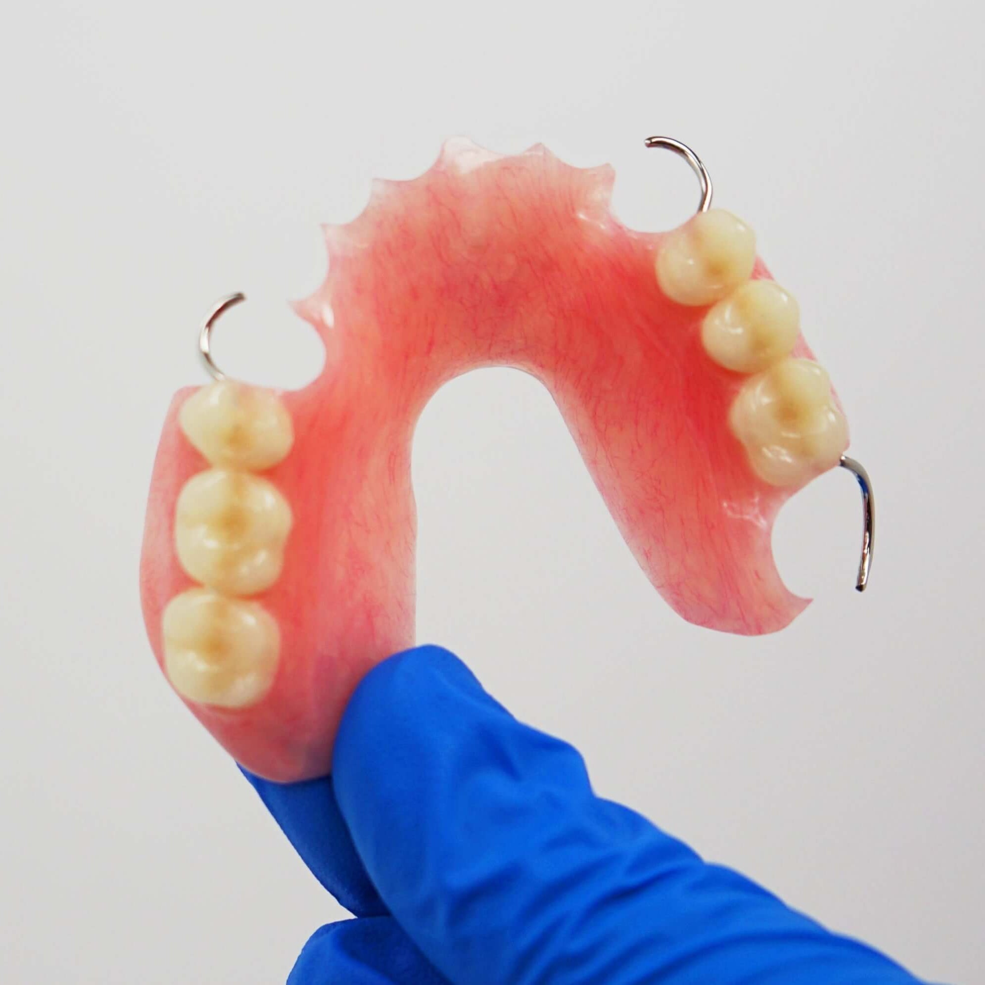 Blue Gloves Holding Acrylic Partial Denture