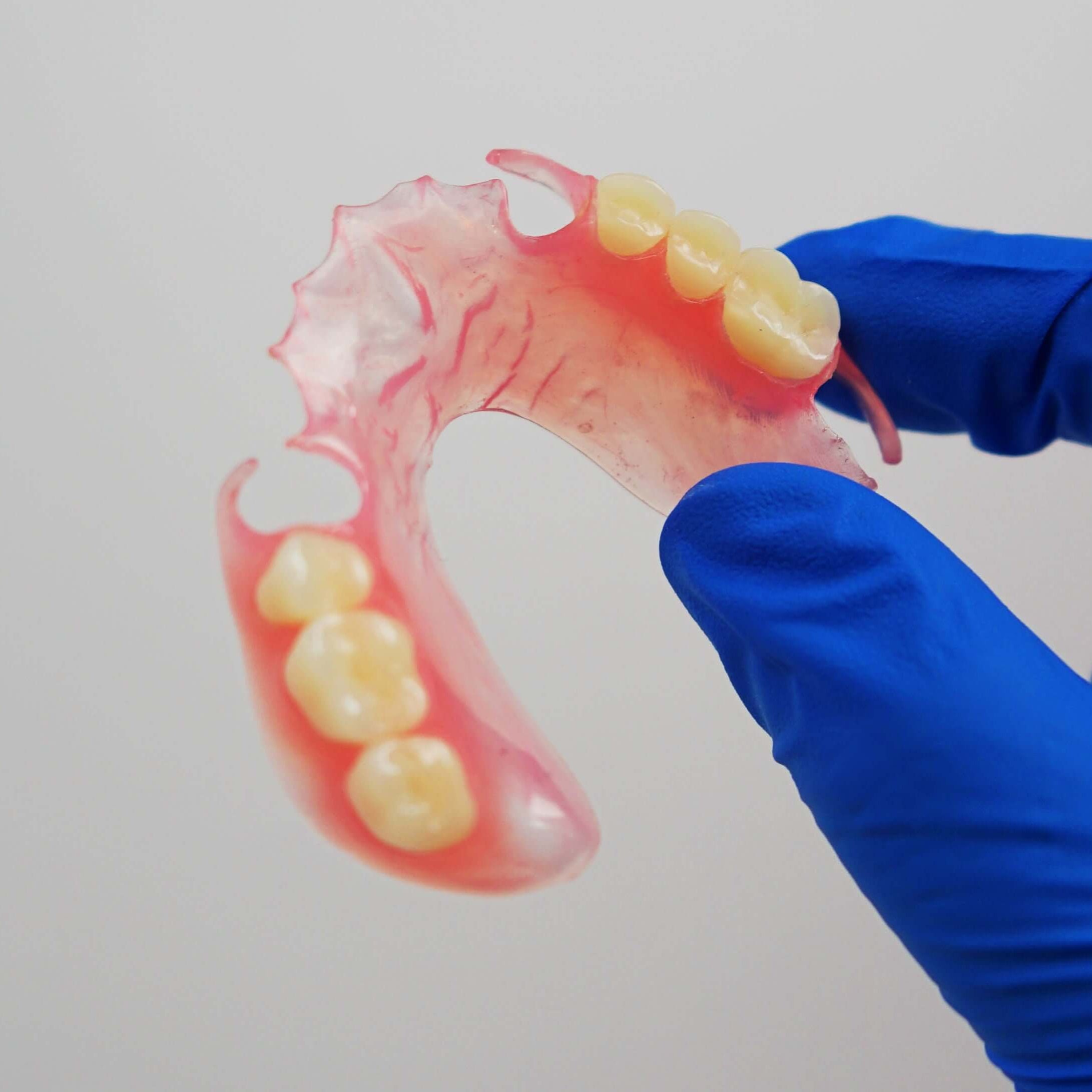Holding a Flexible Partial Denture