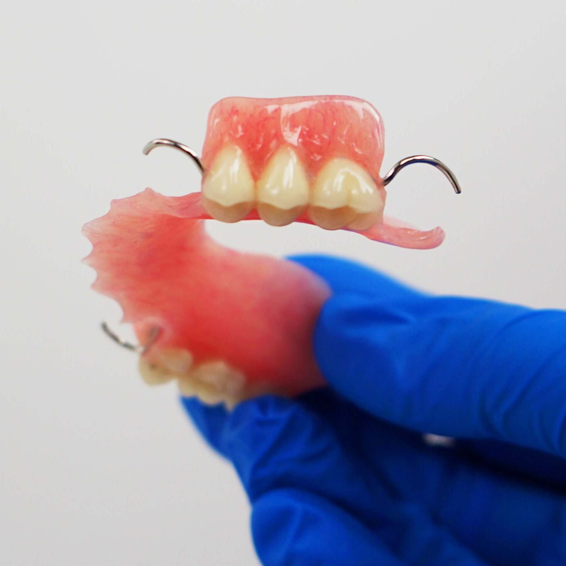 Acrylic Partial Flipper Denture