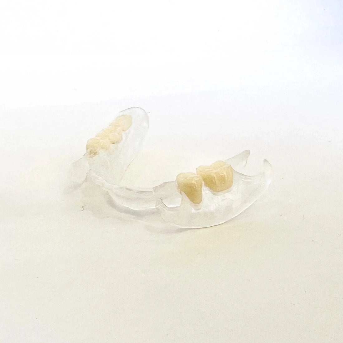 Affordable Clear Flexible Partial Denture - Revived Smiles