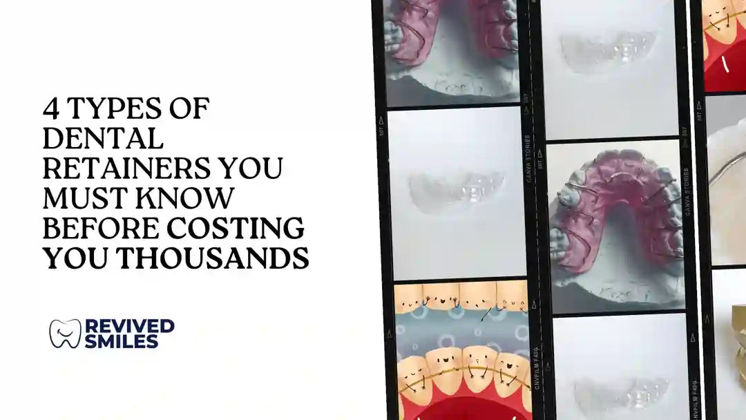 All About Retainers: Discover the Different Types and Find the Best One for You