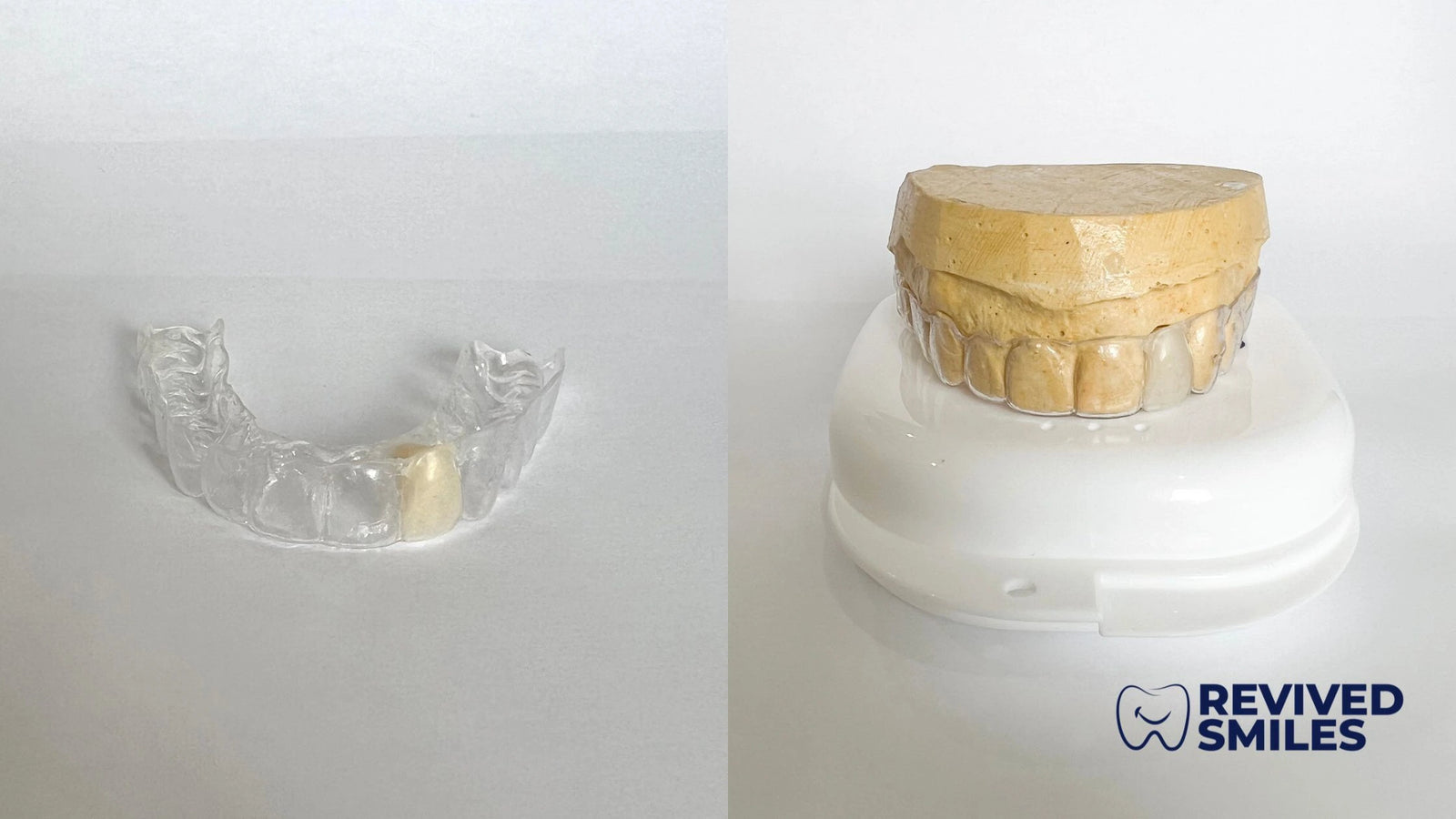 Essix Partial Denture Retainer - Revived Smiles