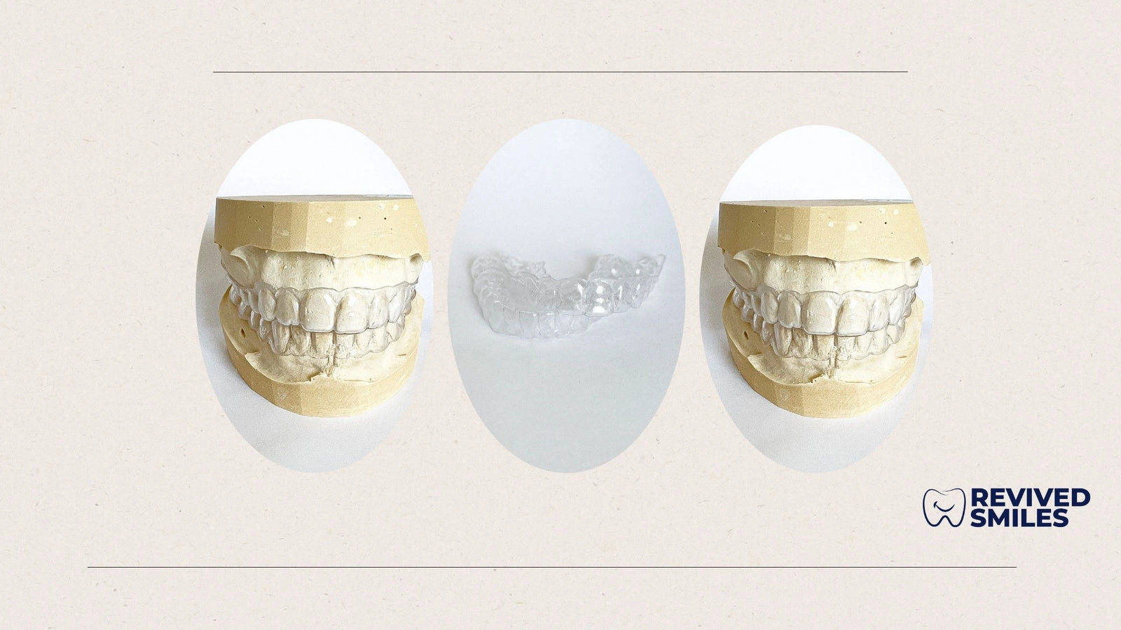 Dentist Quality Essix Retainer - Revived Smiles