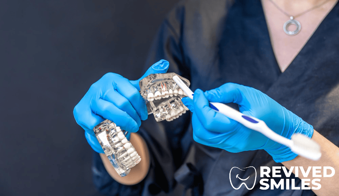 Partial Dentures with Metal Clasps: The Ultimate Guide to a Beautiful Smile