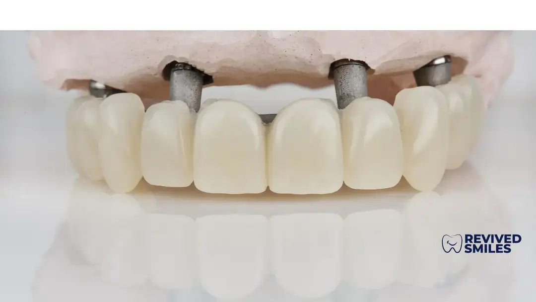 Pop-on Veneers - Revived Smiles