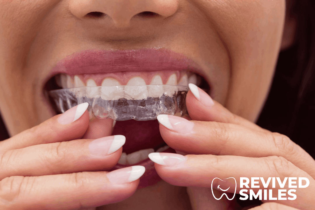 How Much Do Retainers Cost? Essential Cost Insights You Need to Know