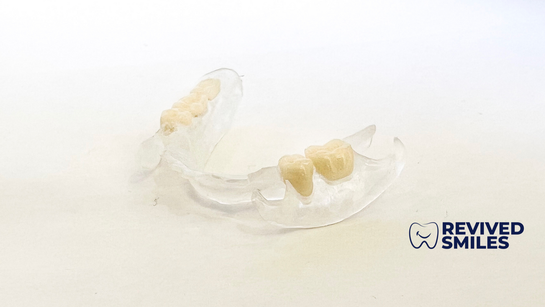 Introducing the New Flexite Partial Denture - Revived Smiles