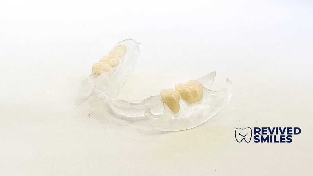 Clear Flexible Partial Dentures: The Secret to a Comfortable, Invisible Smile