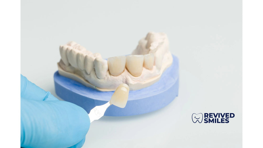 Pros and Cons About Veneers - Revived Smiles