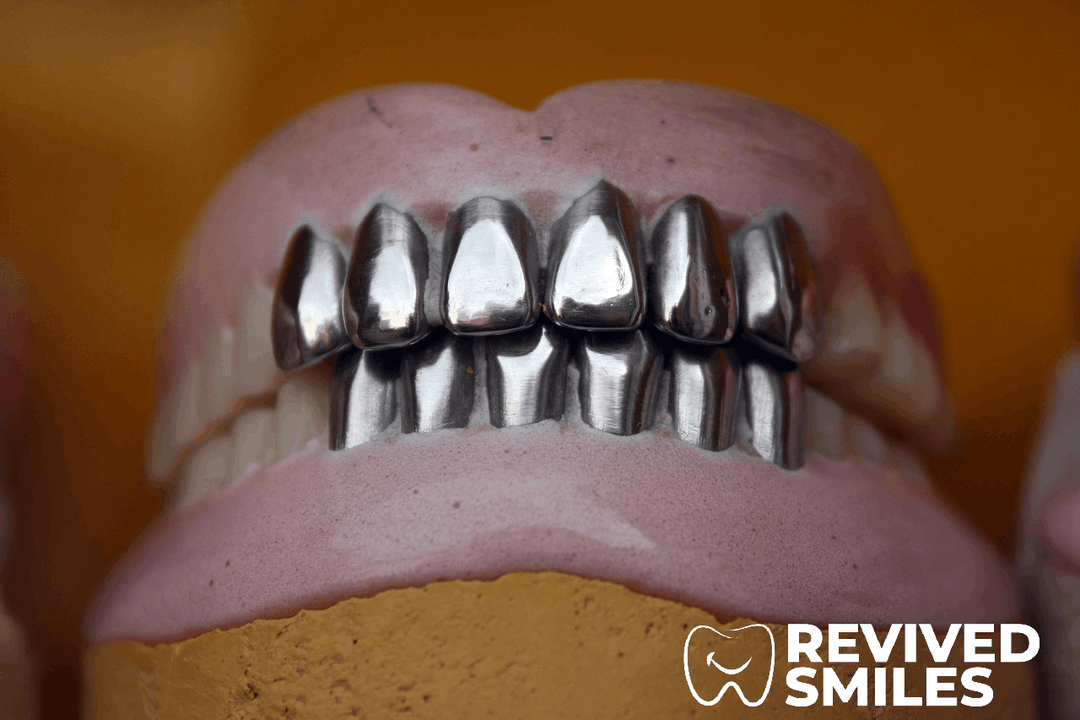 Say Goodbye to Metal Clasps: Discover the Top Types of Flexible Dentures