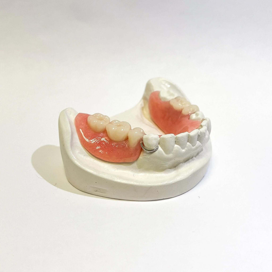 Dernture Rpd Flipper Affordable Acrylic Partial Denture Flipper - Revived Smiles
