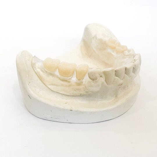 Dentadura parcial transparente y flexible