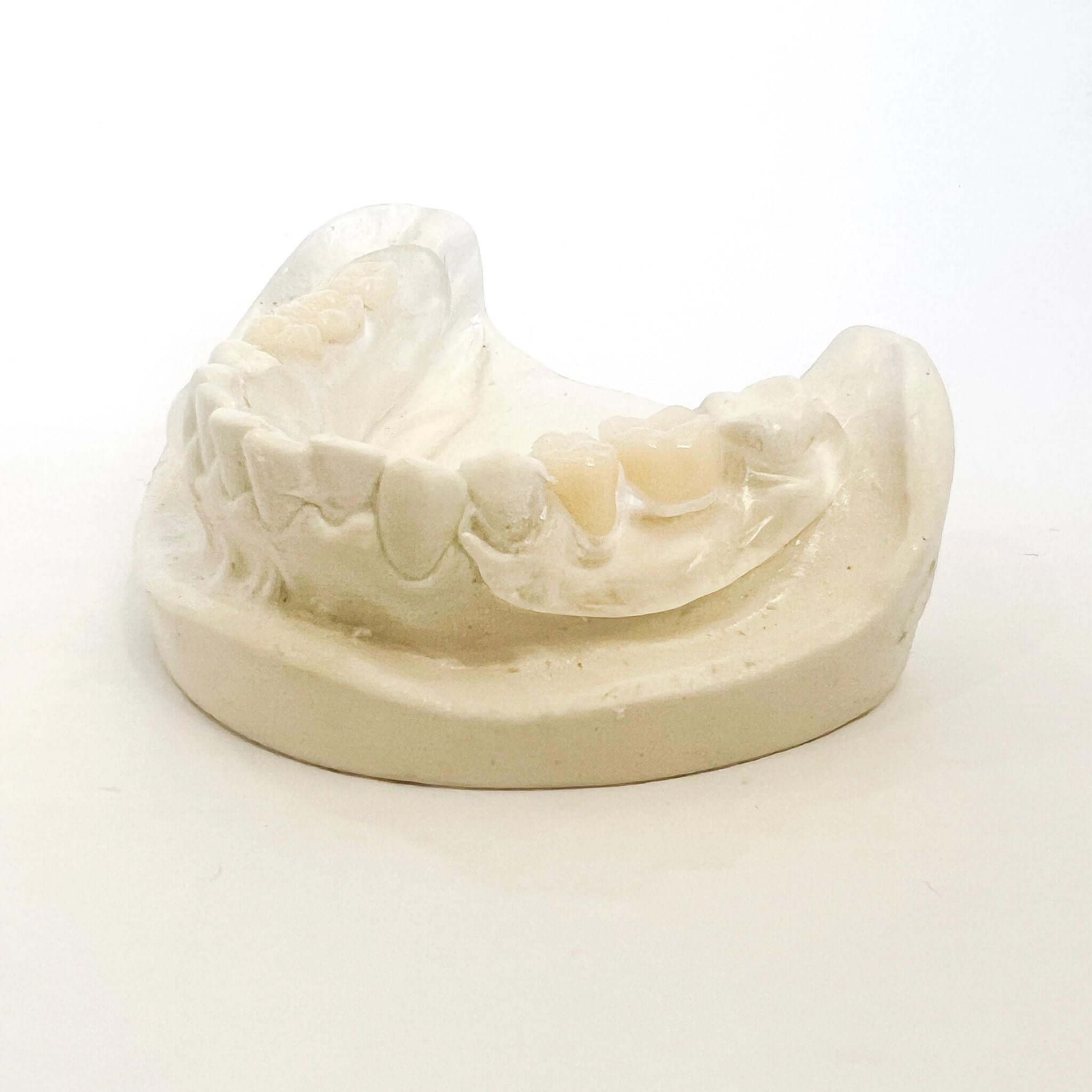 Clear Flexible Partial Denture