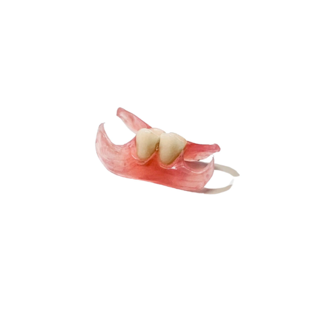 Unilateral Partial Denture