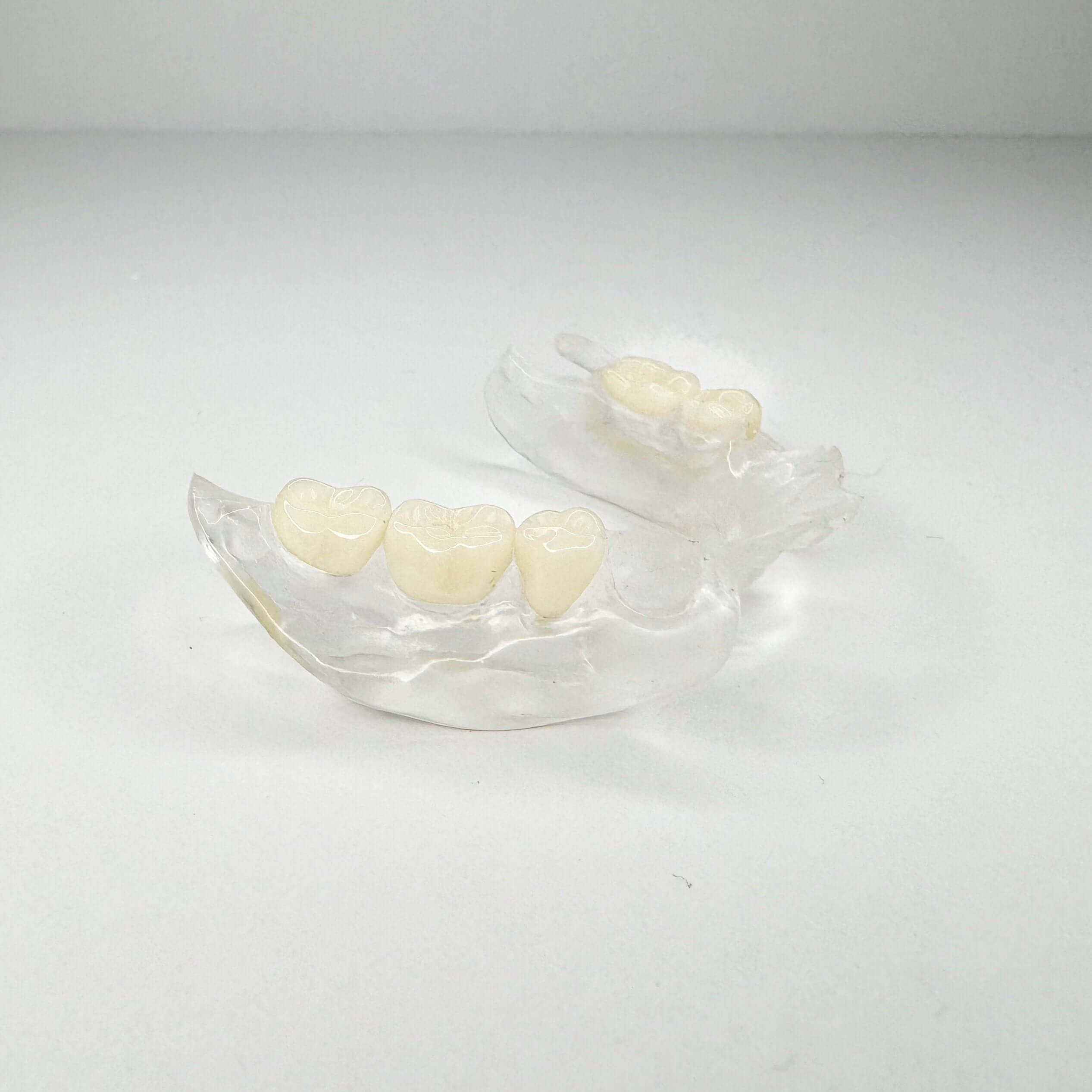 Clear Flexible Partial Denture