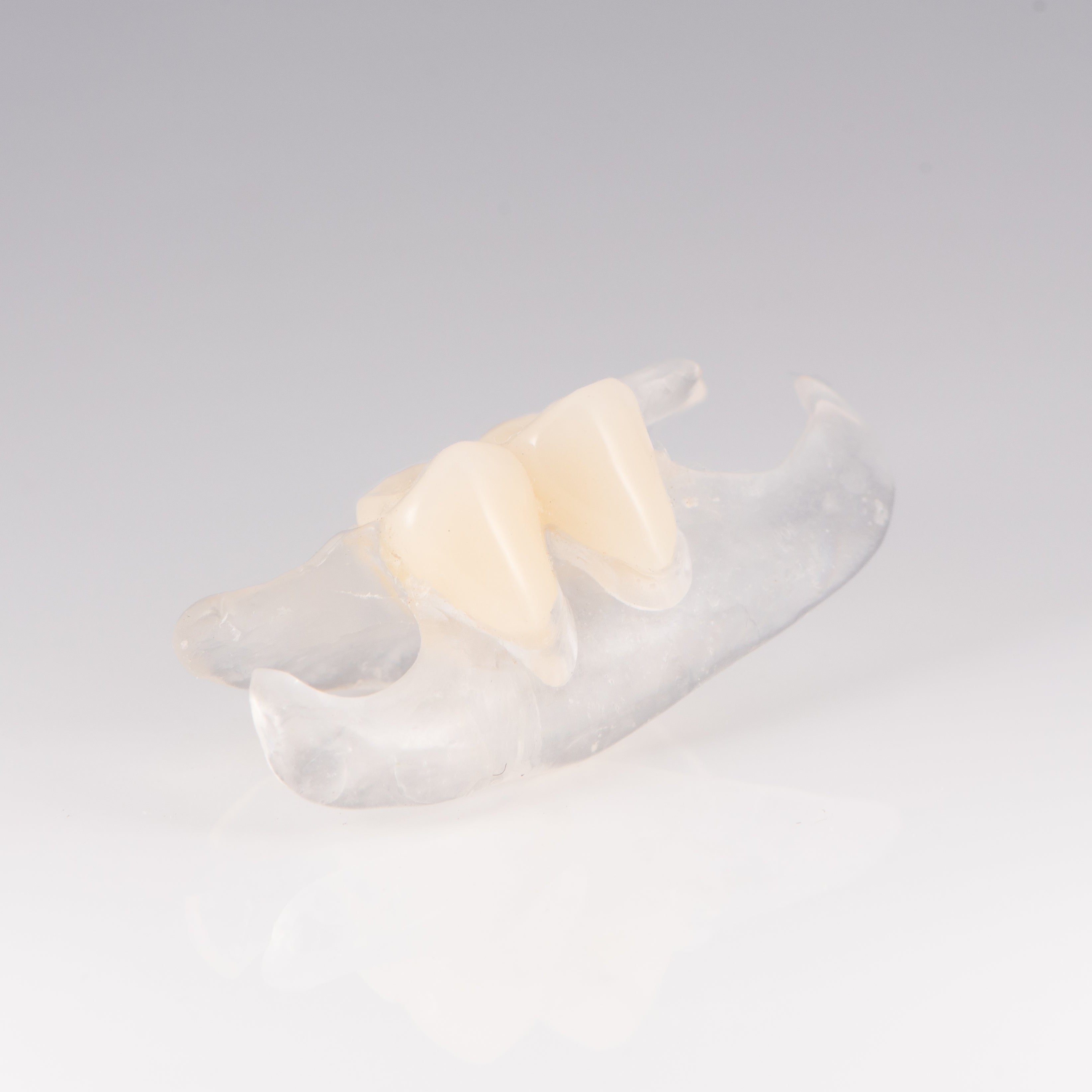 Clear Unilateral Partial Denture