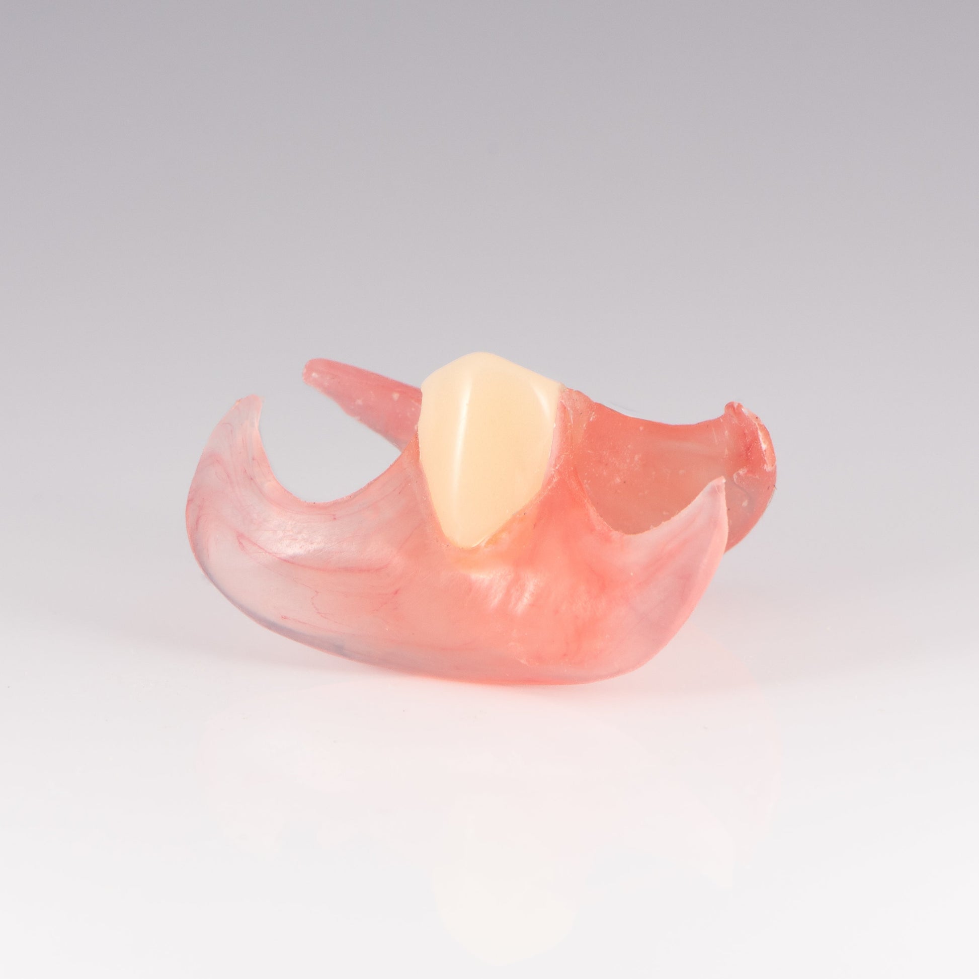 One Tooth Unilateral Partial Denture