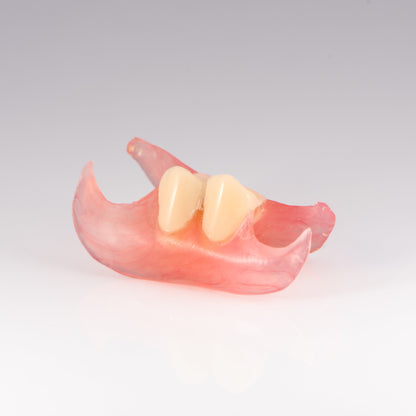 Two Tooth Unilateral Partial Denture