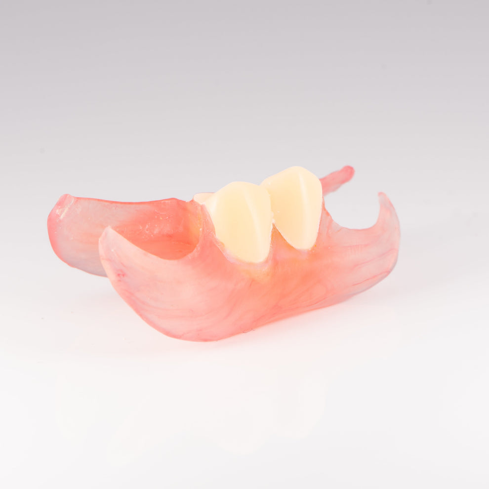 Unilateral Partial Denture - Single Denture for 1-3 Teeth – Revived Smiles