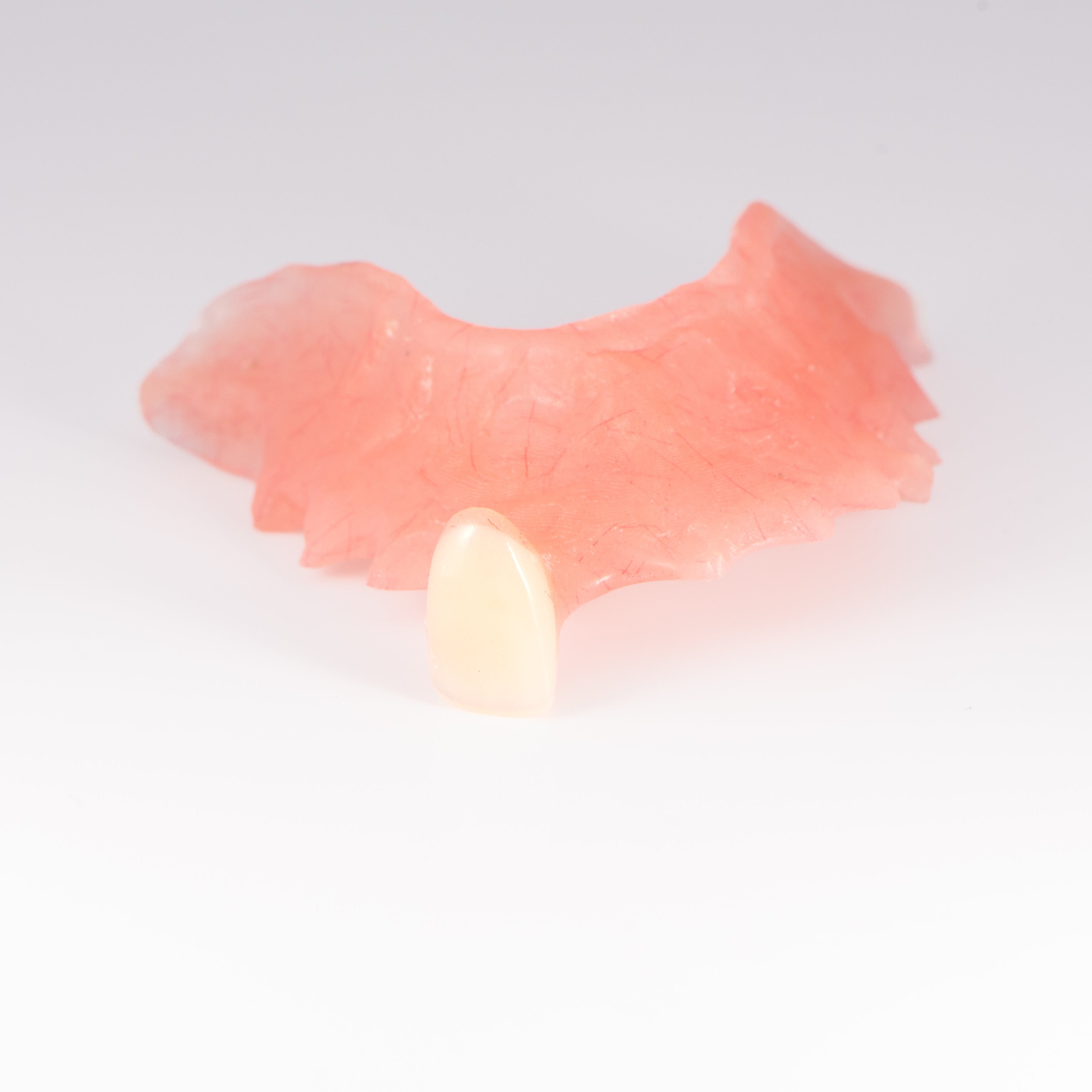 Dentadura postiza de aleta parcial acrílica