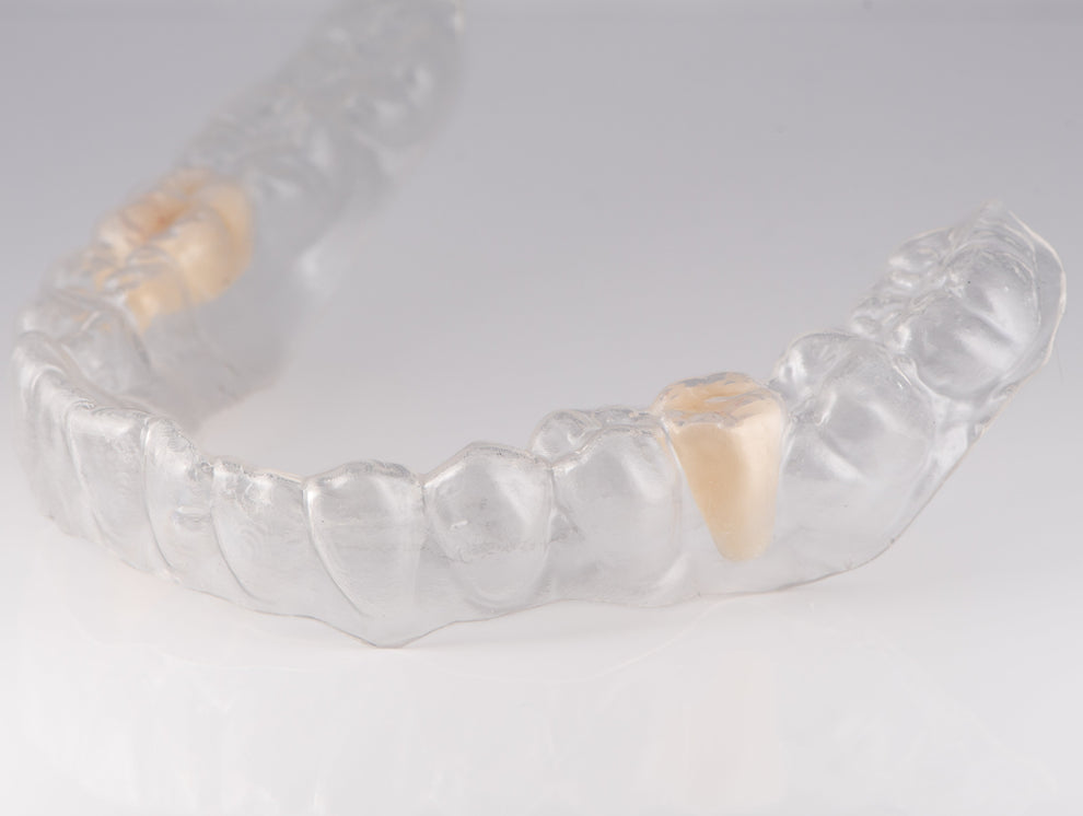 Essix Partial Denture Retainer - Buy Online – Revived Smiles