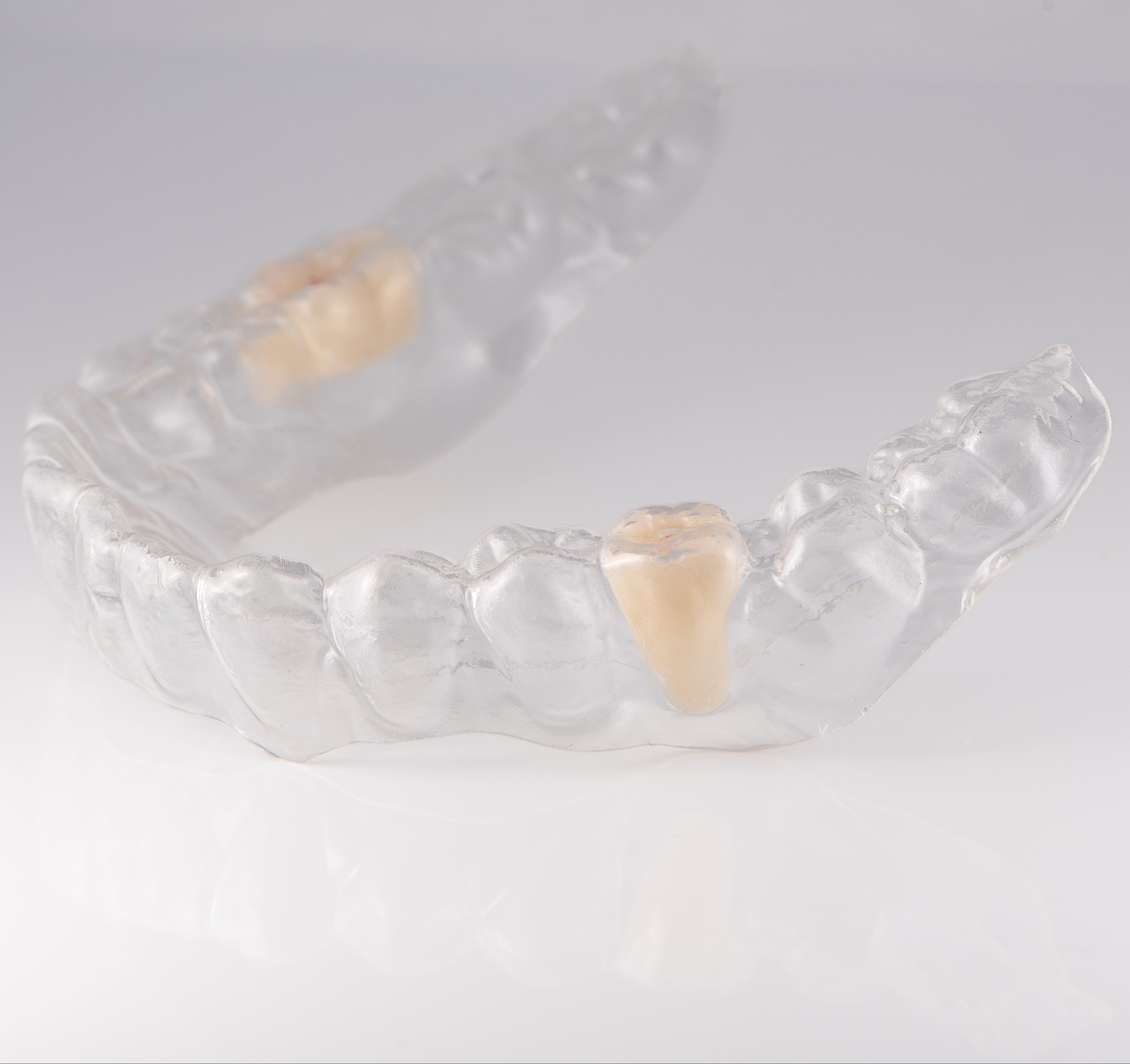 Revived Smiles Essix Partial Denture Retainer - Thumbnail 4