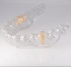 Essix Partial Denture Retainer - Buy Online – Revived Smiles