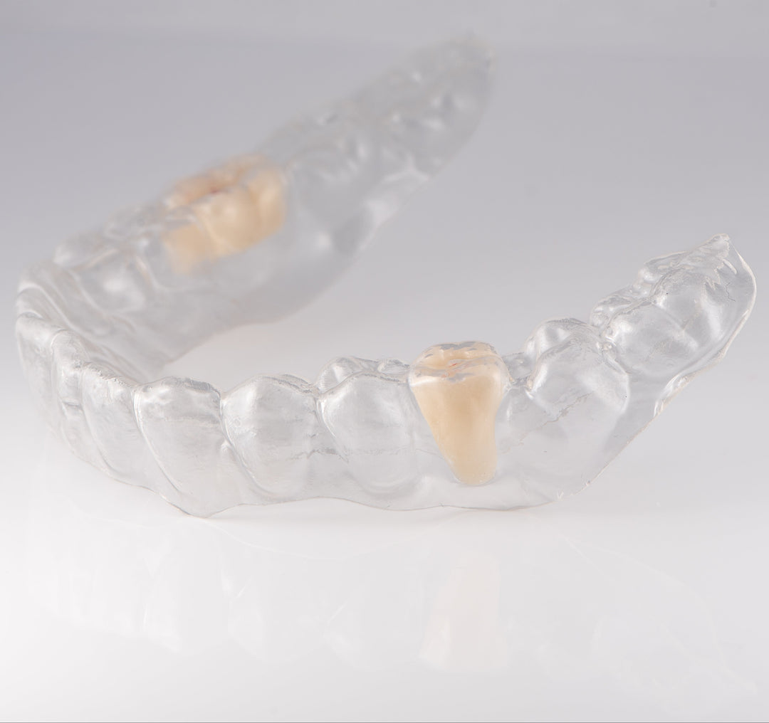 Essix Partial Denture Retainer