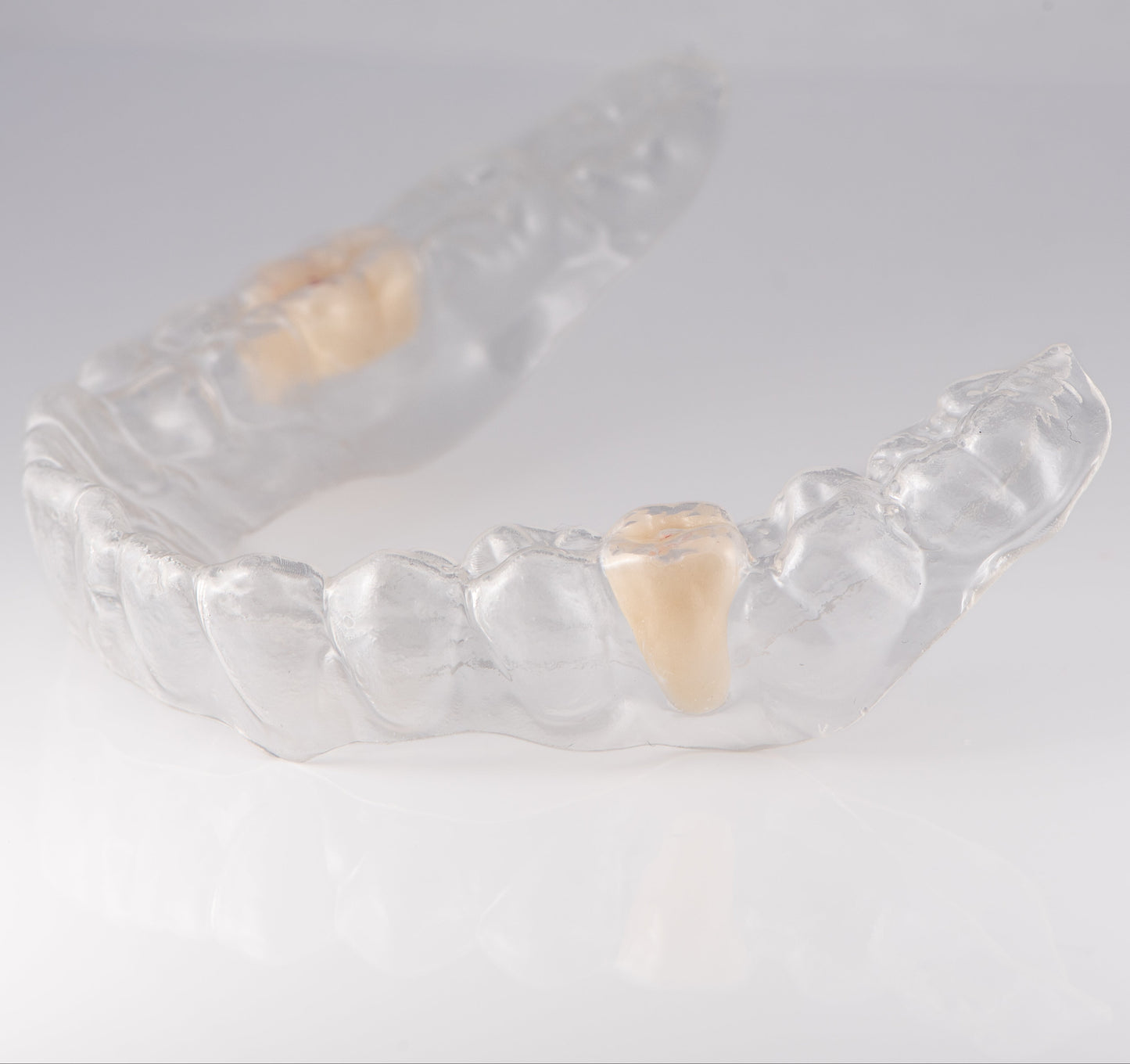 Essix Partial Denture Retainer