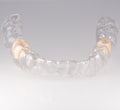 Essix Partial Denture Retainer