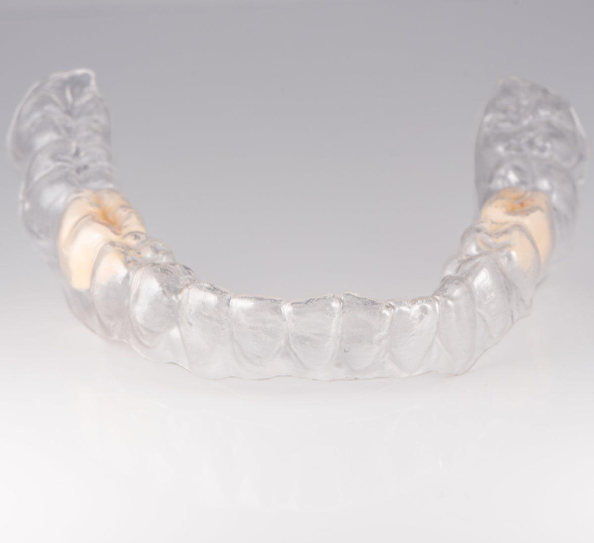 Essix Partial Denture Retainer - Buy Online – Revived Smiles