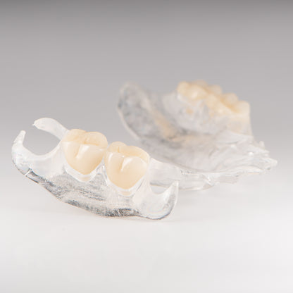 Clear Flexible Partial Denture on Gray Background