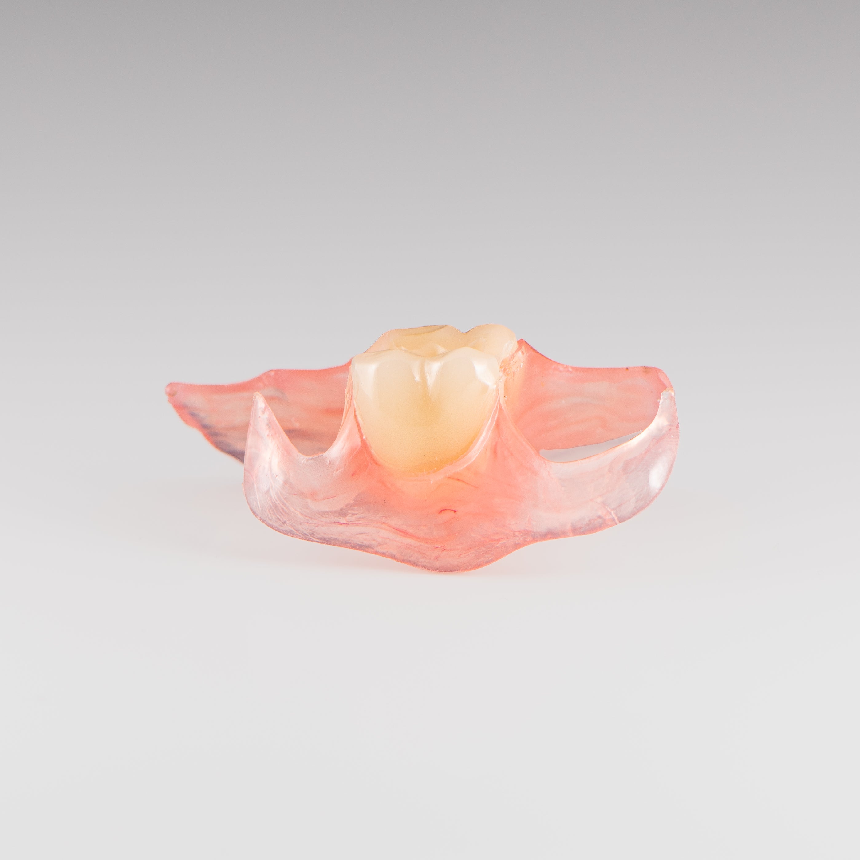 One-Tooth Unilateral Partial Denture on Gray Background