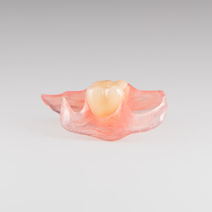 One-Tooth Unilateral Partial Denture on Gray Background
