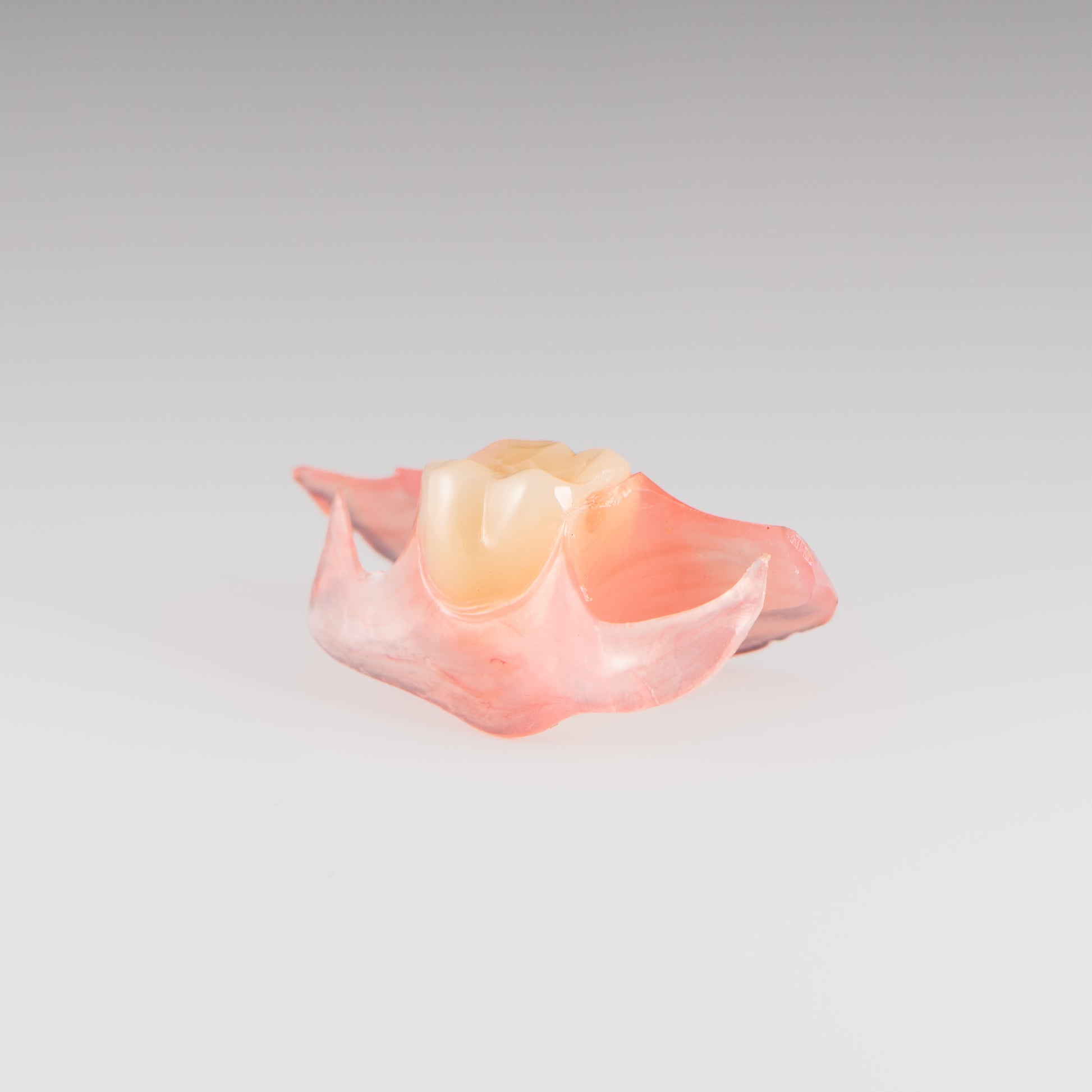 One-Tooth Unilateral Partial Denture on Gray Background