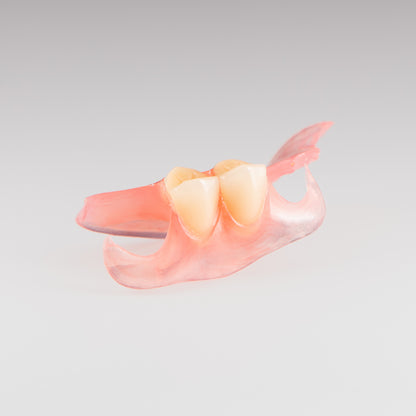 Two-Tooth Unilateral Partial Denture on Gray Background