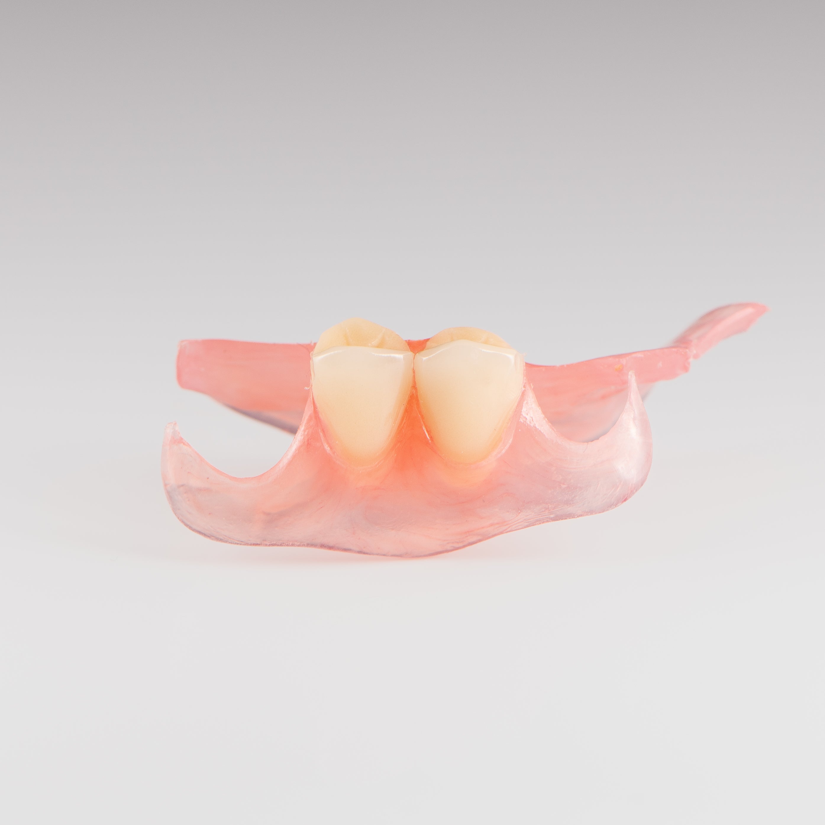 Two-Tooth Unilateral Partial Denture on Gray Background