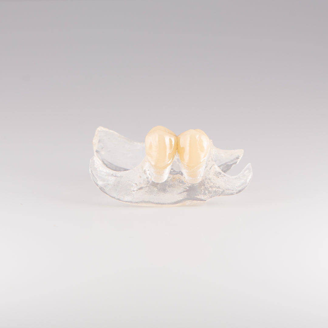Clear Unilateral Partial Denture with Gray Background