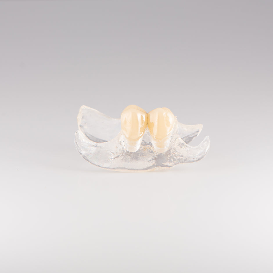 Essix Partial Denture Retainer - Buy Online – Revived Smiles