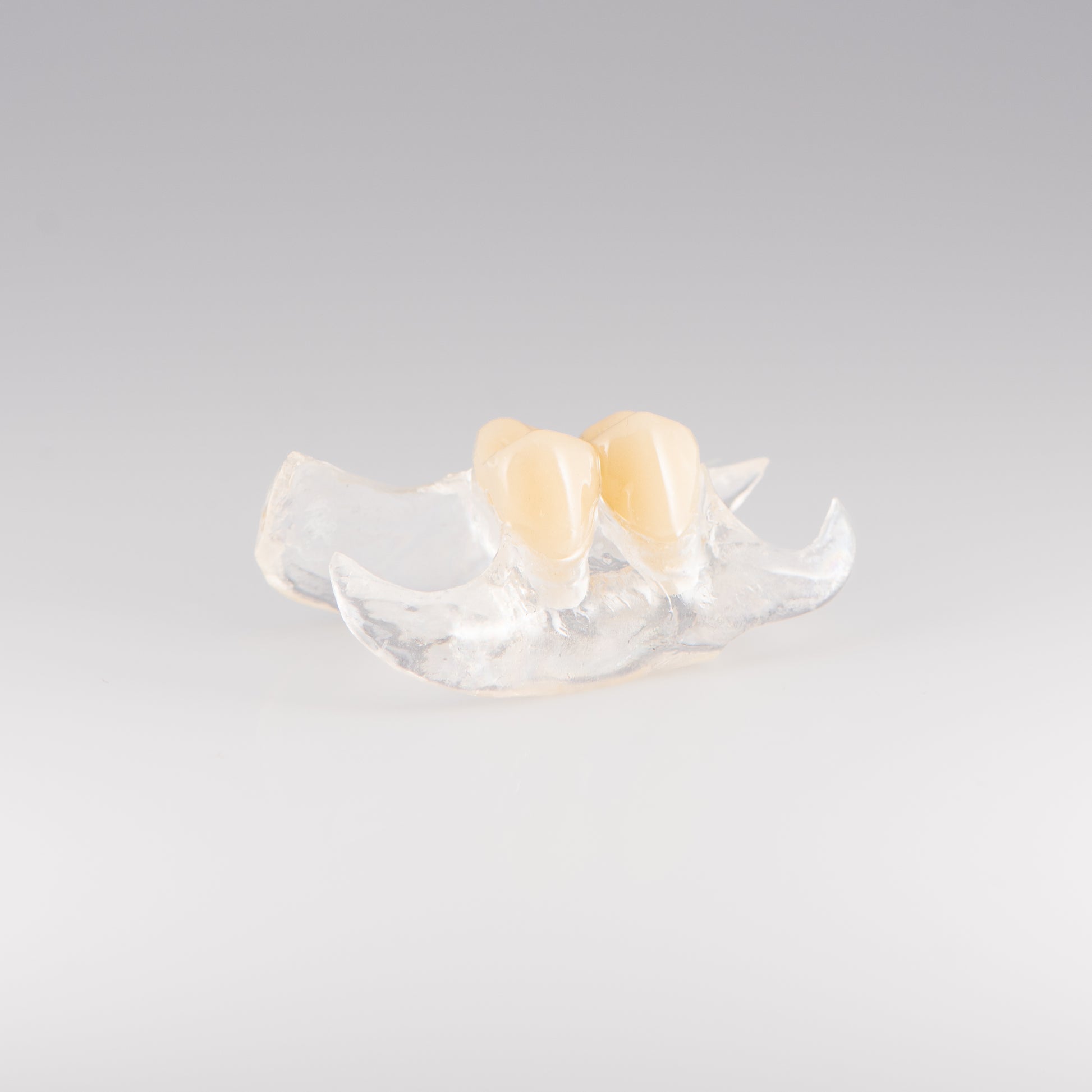Clear Unilateral Partial Denture with Gray Background