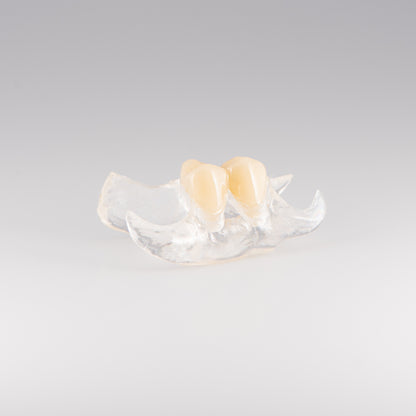 Clear Unilateral Partial Denture with Gray Background