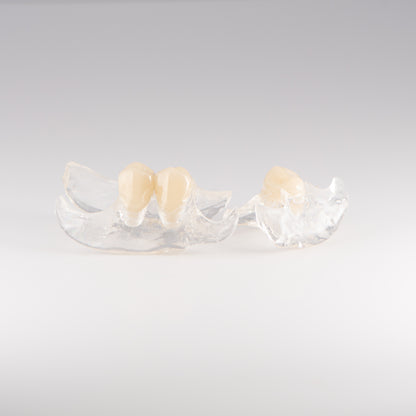Two Clear Unilateral Partial Denture with Gray Background