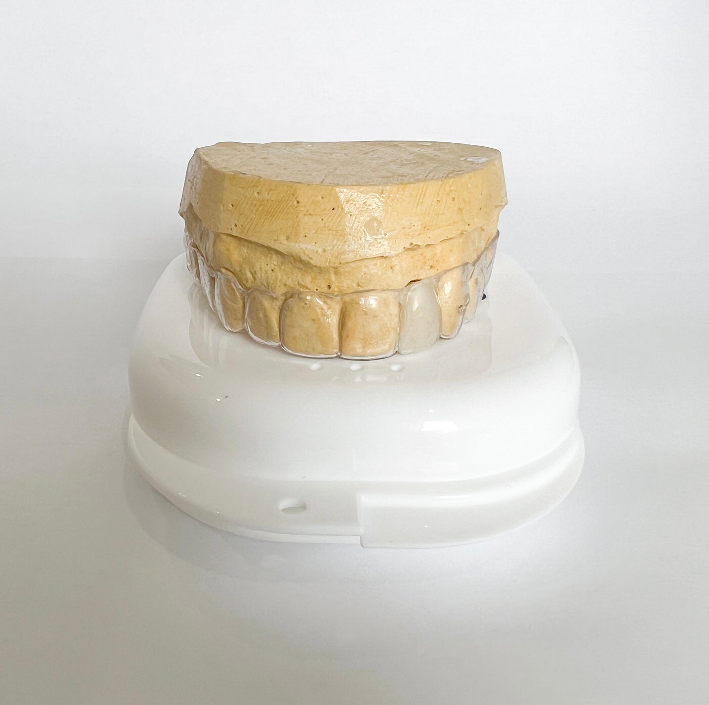Essix Partial Denture Retainer